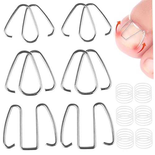 Correcteur d'ongles incarnés 6 pièces en fer avec élastique portable